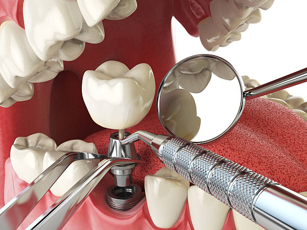 Best Cosmetic Emergency Dentistry in Highlands Ranch, CO